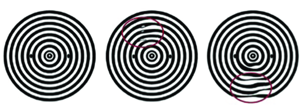 NI TBUT 검사 시 마이어상*Graphic of theoretical Placido ring distortions appearing after last blink10